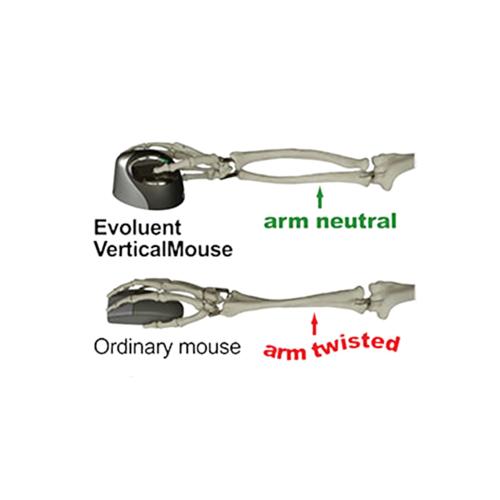 Rato Evoluent Vertical Mouse 4, rato ergonómico profissional. JANS-it Posição correta do braço e mão.